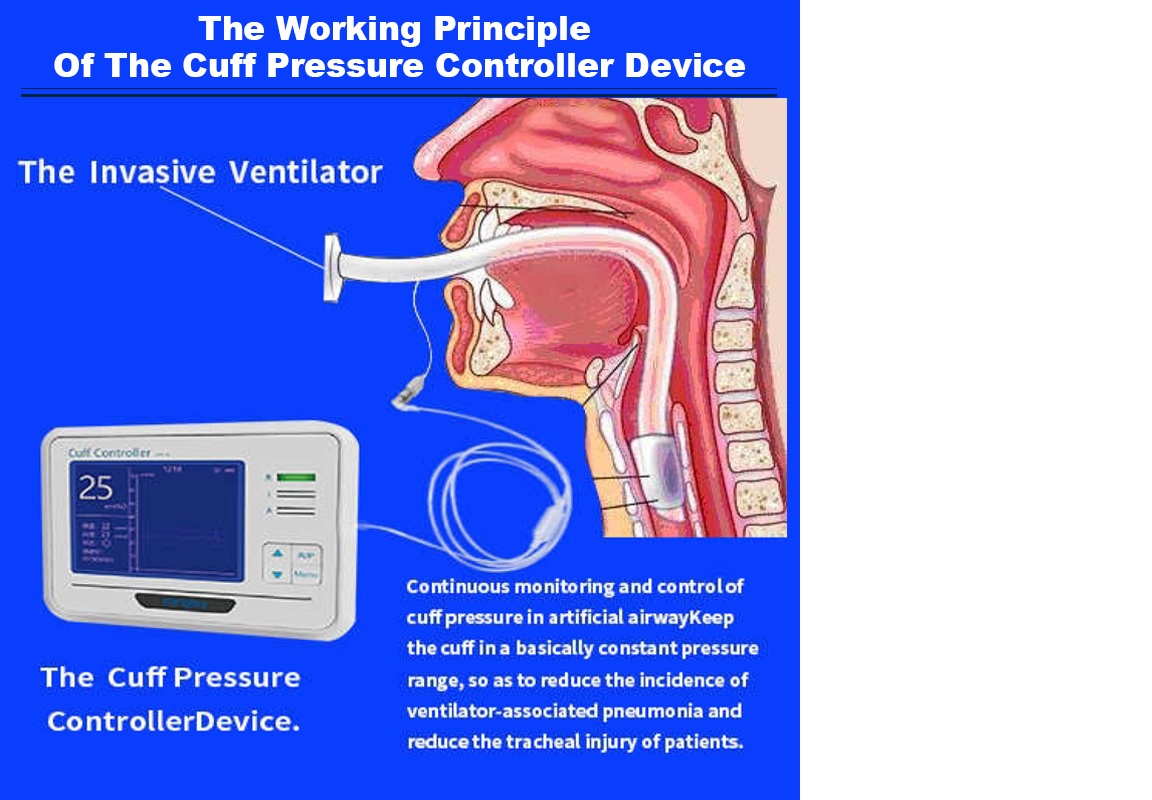 Thiết bị điều khiển áp lực bóng chèn nội khí quản (Thiết bị điều khiển áp suất vòng bít) - Cuff Pressure Controller Device