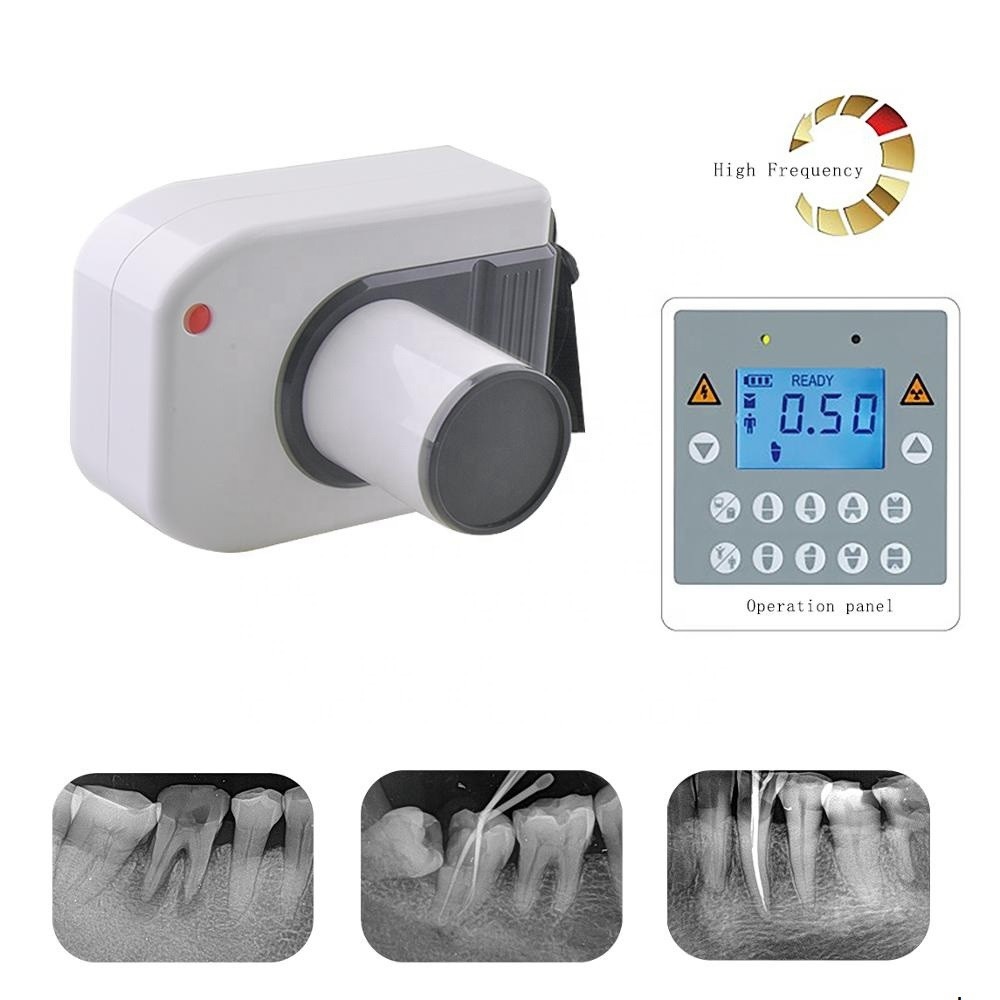 Máy X_Quang nha khoa di động DC tần số cao (rất cần thiết trong phẫu thuật cấy ghép implant) & có thể kết nối với hệ thống chụp X quang kỹ thuật số trong miệng