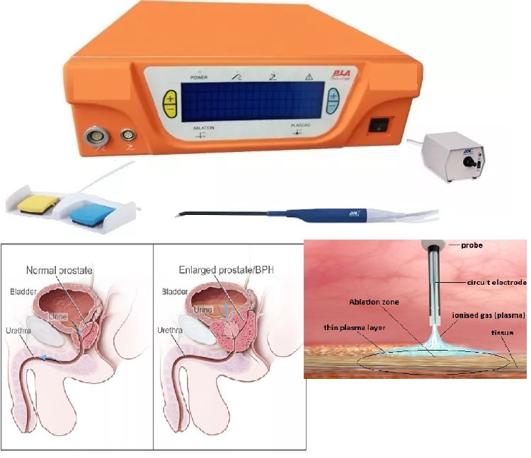 Máy phẫu thuật tiết niệu và U xơ tiền liệt tuyến bằng công nghệ Plasma